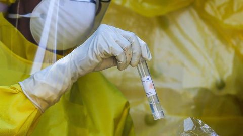 País Vasco fabrica miles de tubos para test rápidos de coronavirus en tiempo récord