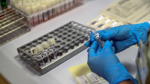 Dos pruebas y una encuesta epidemiológica: así será el estudio de seroprevalencia que pondrá en marcha el Gobierno