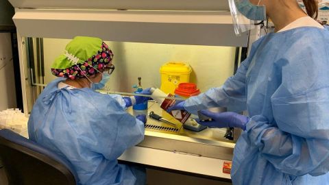Hombre de más de 60 años con patologías previas, este es el perfil de los pacientes por coronavirus en la UCI
