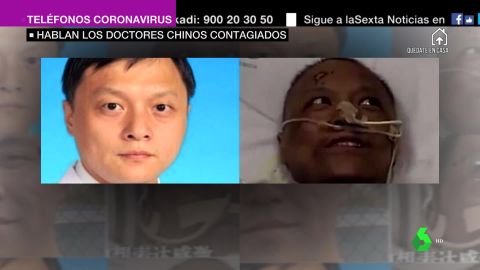 Habla el médico chino cuya piel cambió de color tras sufrir coronavirus: "Estoy prácticamente recuperado"