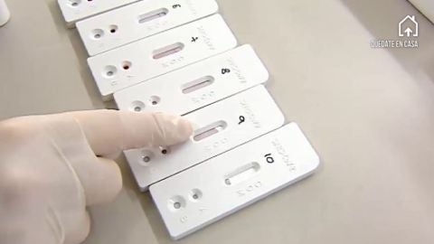 Los laboratorios privados hacen test de coronavirus por prescripción médica