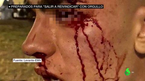 Crecen las agresiones homófobas: 92 solo en Cataluña este 2021